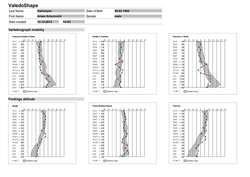 Вариант графического представления данных исследования с помощью неинвазивного нерентгеновского анализатора  «Valedo Shape»